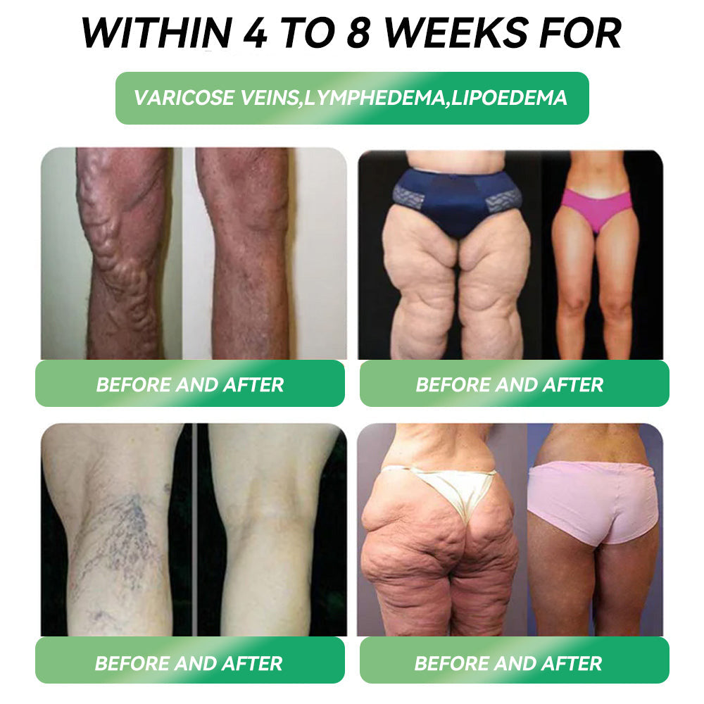 [Offisiell Butikk] 𝐏𝐄𝐀𝐊𝐀® 𝐆𝐋𝐏-𝟏 𝐕𝐞𝐤𝐭𝐭𝐚𝐩 𝐎𝐫𝐚𝐥 𝐋ø𝐬𝐧𝐢𝐧𝐠 – 👨‍⚕️ Fedme, Hjerte- og karsykdommer, Diabetes, Søvnapné, Leddproblemer og Mer💪
