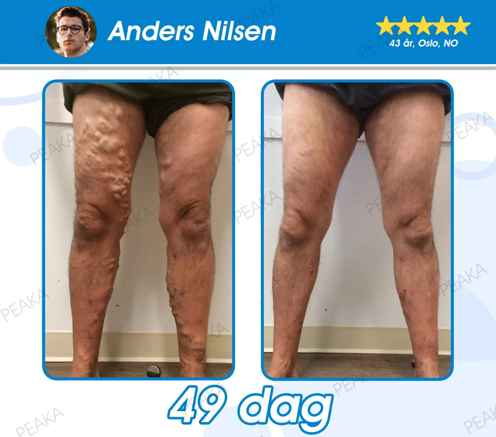[Offisielt autorisert butikk] PEAKA® GLP-1 Slankende og Helsefremmende Ultra Konsentrerte Essensielle Væskeperler – NAD+, Moringa, ACV og Keto BHB (✅raskvirkende, langvarig effekt, retter seg mot diabetes, fedme og hjerte- og karsykdommer)