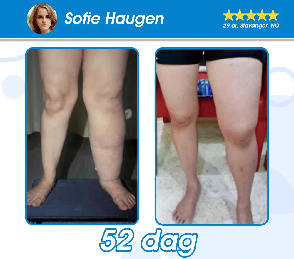 Offisielt autorisert butikk -𝘗𝘌𝘈𝘒𝘈® 𝘎𝘓𝘗-1 𝘚𝘭𝘢𝘯𝘬𝘦𝘯𝘥𝘦 & 𝘏𝘦𝘭𝘴𝘦 𝘜𝘭𝘵𝘳𝘢 𝘒𝘰𝘯𝘴𝘦𝘯𝘵𝘳𝘦𝘳𝘵 𝘌𝘴𝘴𝘦𝘯𝘴𝘷æ𝘴𝘬𝘦𝘱𝘦𝘳𝘭𝘦𝘳 – 𝘕𝘈𝘋+ 𝘔𝘰𝘳𝘪𝘯𝘨𝘢 & 𝘌𝘱𝘭𝘦𝘤𝘪𝘥𝘦𝘳𝘦𝘥𝘥𝘪𝘬 & 𝘒𝘦𝘵𝘰 𝘉𝘏𝘉 (✅ rask, langvarig effekt, adresserer diabetes, fedme og hjerte- og karsykdommer) ⚡