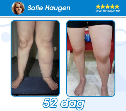 Offisielt autorisert butikk -𝘗𝘌𝘈𝘒𝘈® 𝘎𝘓𝘗-1 𝘚𝘭𝘢𝘯𝘬𝘦𝘯𝘥𝘦 & 𝘏𝘦𝘭𝘴𝘦 𝘜𝘭𝘵𝘳𝘢 𝘒𝘰𝘯𝘴𝘦𝘯𝘵𝘳𝘦𝘳𝘵 𝘌𝘴𝘴𝘦𝘯𝘴𝘷æ𝘴𝘬𝘦𝘱𝘦𝘳𝘭𝘦𝘳 – 𝘕𝘈𝘋+ 𝘔𝘰𝘳𝘪𝘯𝘨𝘢 & 𝘌𝘱𝘭𝘦𝘤𝘪𝘥𝘦𝘳𝘦𝘥𝘥𝘪𝘬 & 𝘒𝘦𝘵𝘰 𝘉𝘏𝘉 (✅ rask, langvarig effekt, adresserer diabetes, fedme og hjerte- og karsykdommer) ⚡